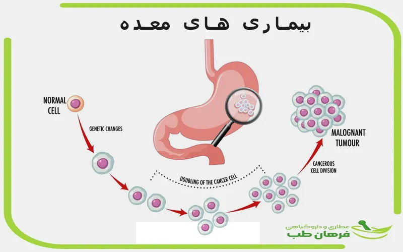 بیماری های معده